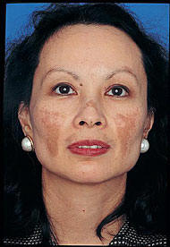 Obagi  - Obagi Skin Care & Skin Care Products That Are Voted The Best Physician-Strength Skin Care Products!