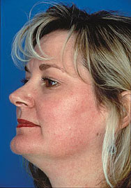Obagi  - Obagi Skin Care & Skin Care Products That Are Voted The Best Physician-Strength Skin Care Products!
