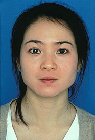 Obagi Skin Treatment