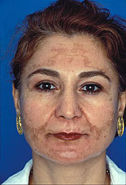 Obagi  - Obagi Skin Care & Skin Care Products That Are Voted The Best Physician-Strength Skin Care Products!