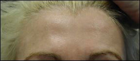 Anti Wrinkle - Improved Appearance