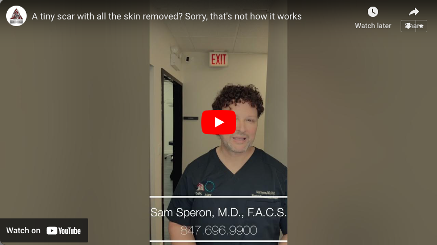 Dr Speron Plastic Surgery Testimonial